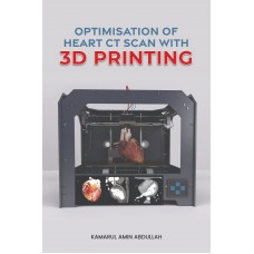 Optimisation Of Heart CT Scan With 3D Printing (2023) 